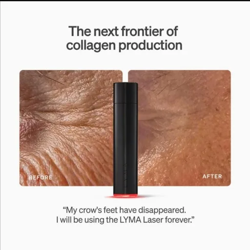 Lyma Laser kit