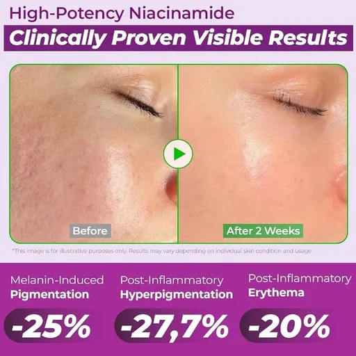 JUMISO 20% Niacinamide Dark Spot Correcting Serum for Face, 1.35 fl oz